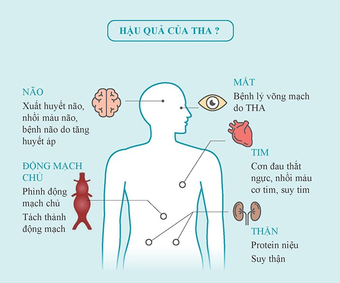 Sổ tay Chung sống với bệnh tăng huyết áp